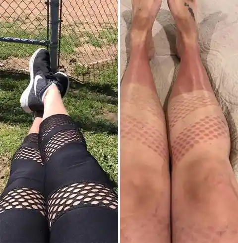 40+ Sunburn Pictures That Makes Us Happy Winter Is Coming